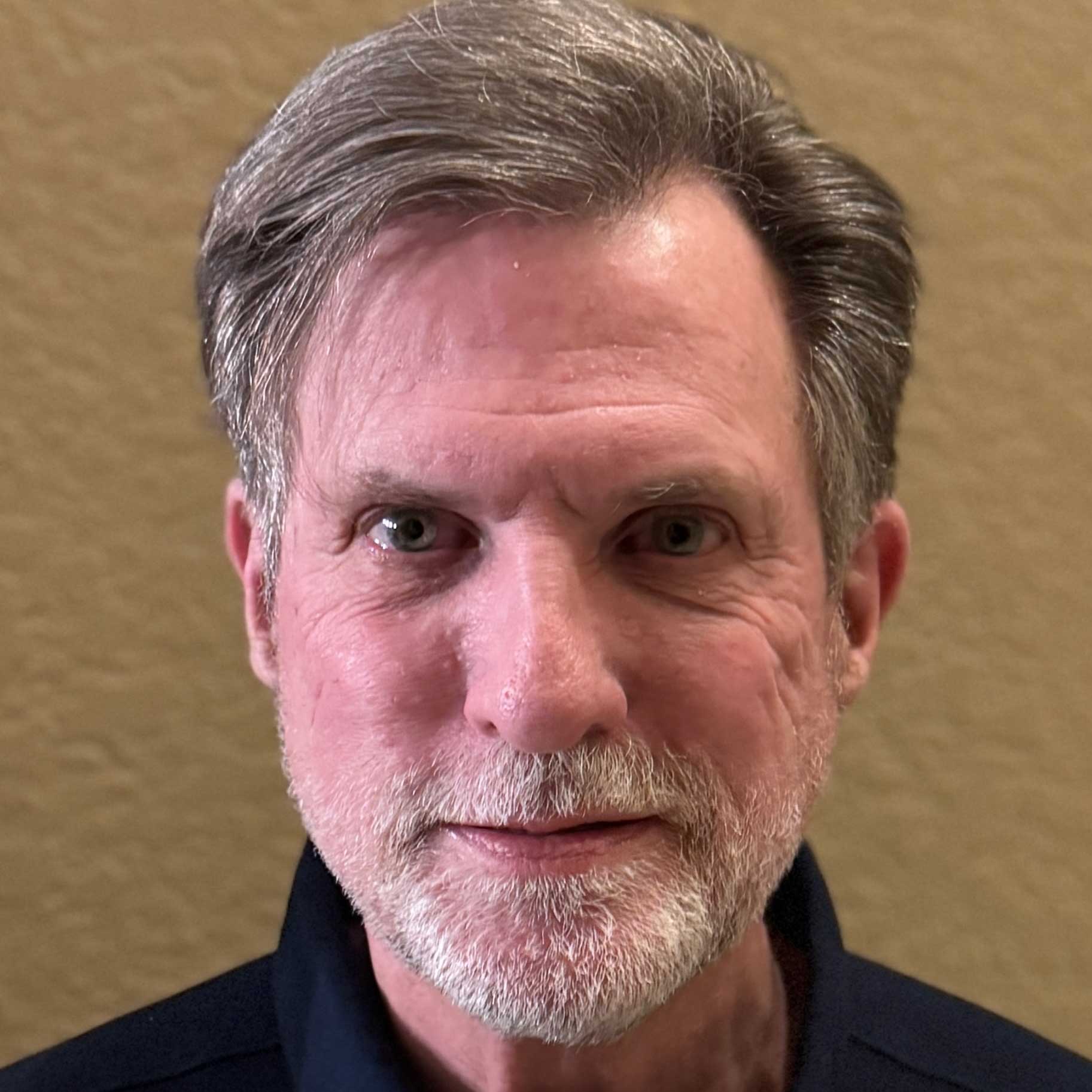 Charles Leach MD - CMO